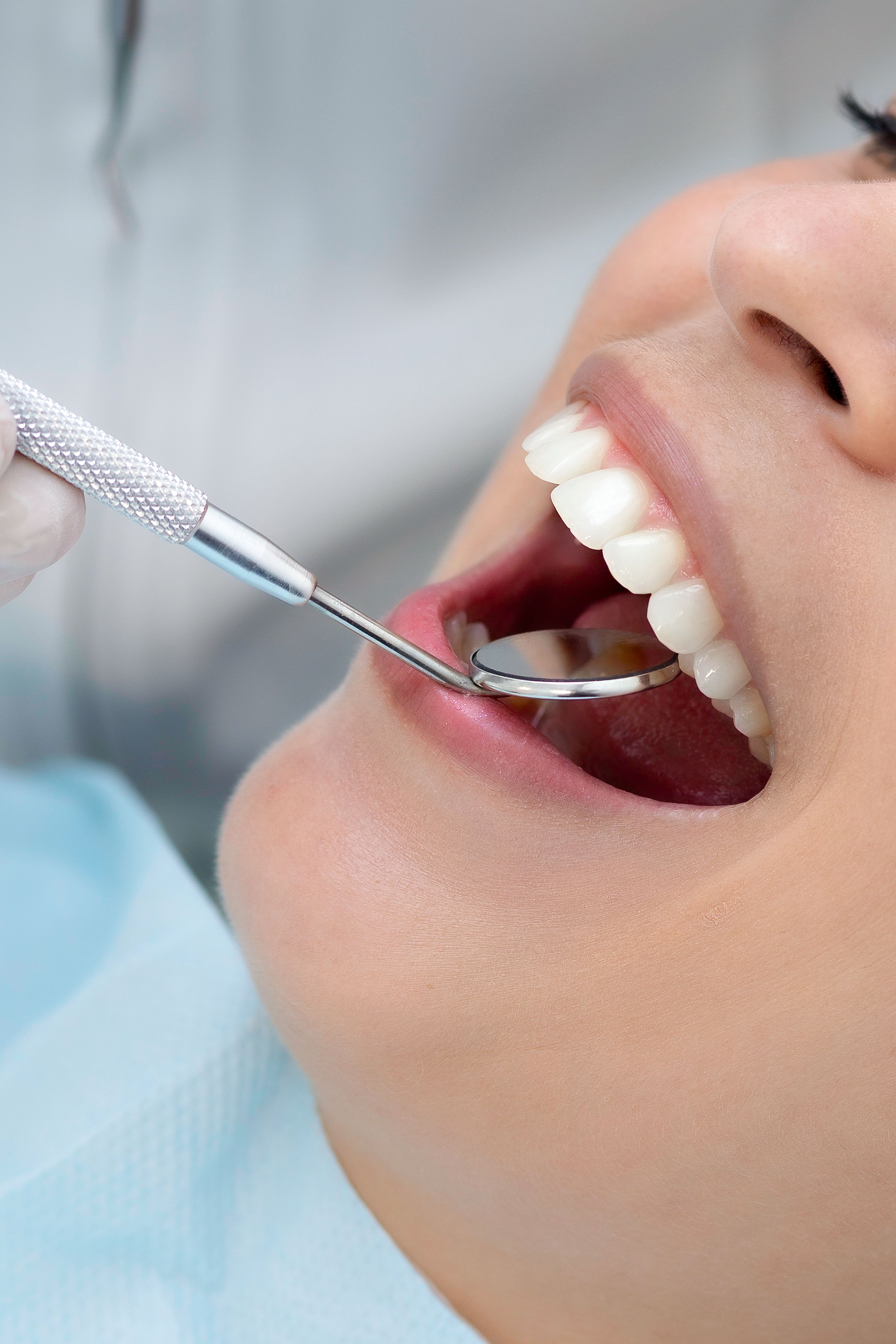 Limpieza Dental